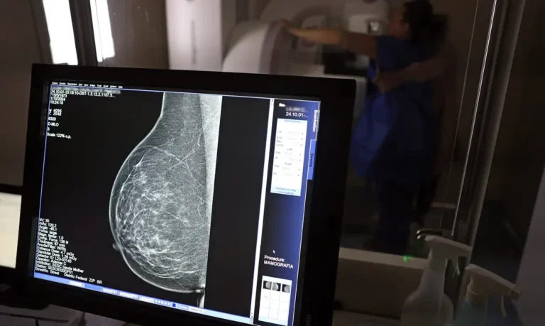 Guia orienta médicos para evitar recusa de mamografia digital