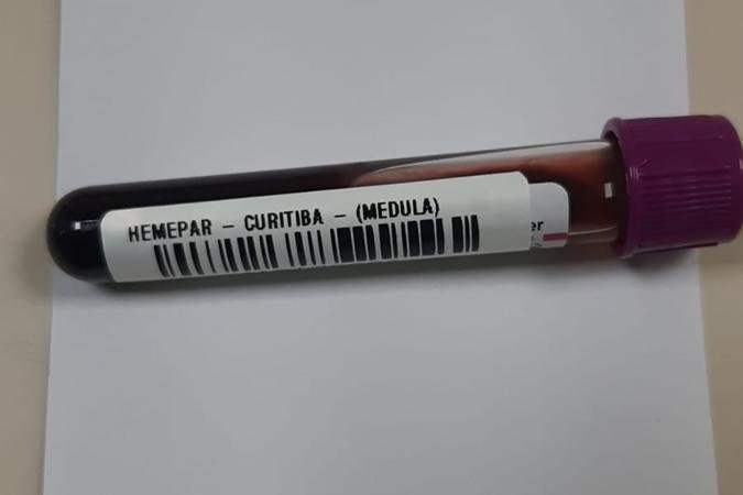 Fevereiro Laranja: Importância do Diagnóstico Precoce na Leucemia